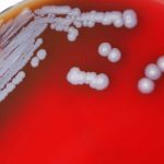 Bacteria that causes melioidosis on a petri dish