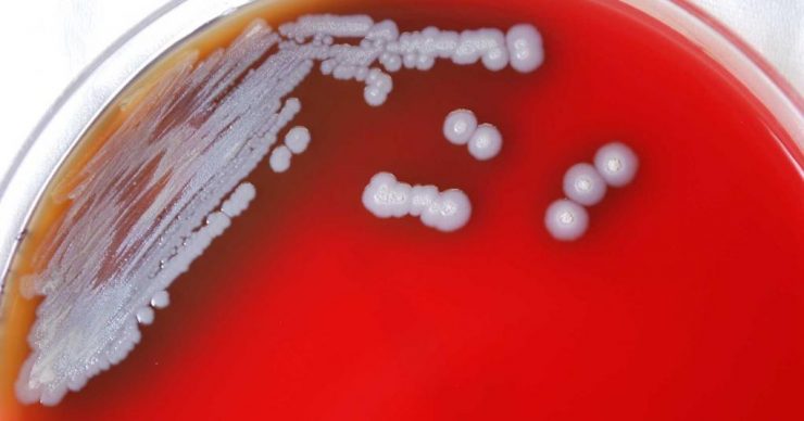 Bacteria that causes melioidosis on a petri dish