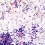 E. rhusiopathiae bacteria staining