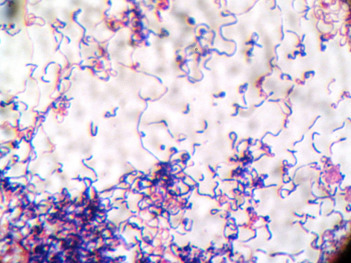 E. rhusiopathiae bacteria staining